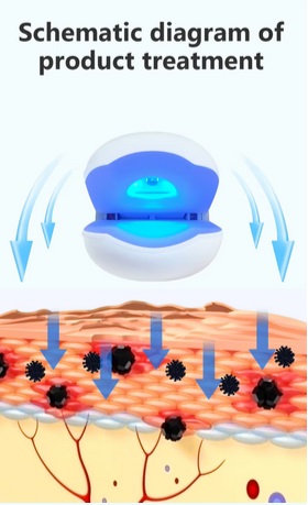 Nail Laser Device 14